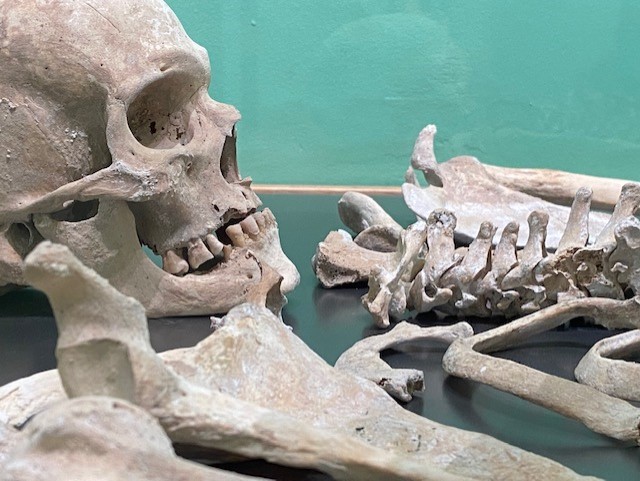 Bio-Archaeology Exhibit at Cyprus Museum – Vigla Archaeological Project